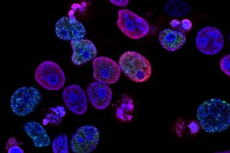 Cancer cells A journey into cancer cells