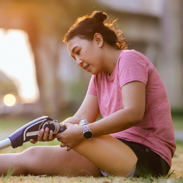 Athlete with prosthetic leg doing warm up exercise on park. Woman wearing prosthetic equipment for jogging. Female with prosthesis of leg