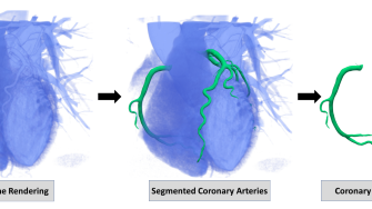 MICCAI 2020: Automated Segmentation Challenge