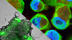 Tumour Microenvironment Group