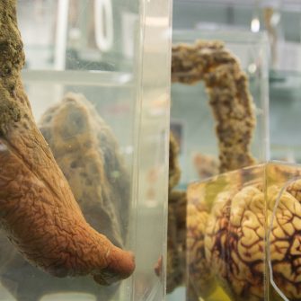 Specimens from the Museum of Human Disease