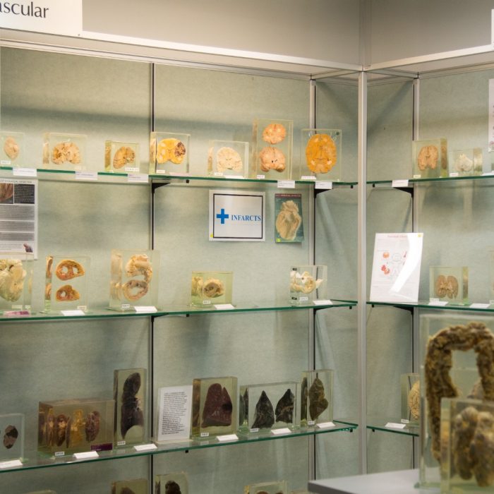 Specimens from the Museum of Human Disease