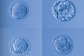 Assisted reproductive technology in Australia and New Zealand 2019
