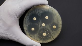 Antibiotic Sensitivity Test. Methods in Detecting Antimicrobial Resistance using petri dish. multidrug resistance