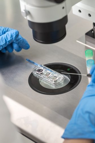 Technician in blue gloves does control check of the in vitro fertilization process using a microscope