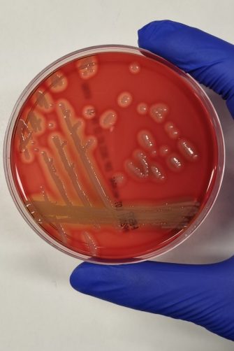 Petri dish growing bacteria
