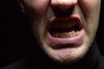 closeup. male mouth with crooked teeth screaming. Black background.