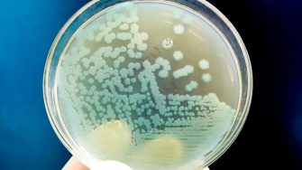 Bacterial colony on patri dish.