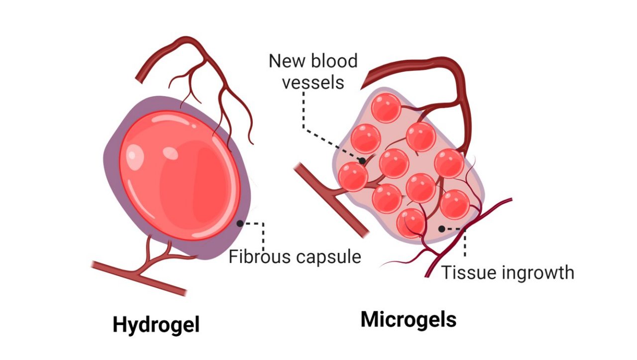 Silk hydrogels get encapsulated and thus isolated from the body, limiting their regenerative potential. Silk microgels support new tissue and blood vessel formation, supporting repair and regeneration.