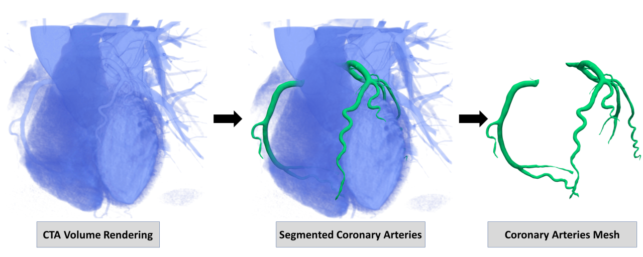 MICCAI 2020: Automated Segmentation Challenge